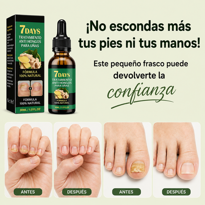 JAYSUING™ -  Tratamiento antifúngico para uñas