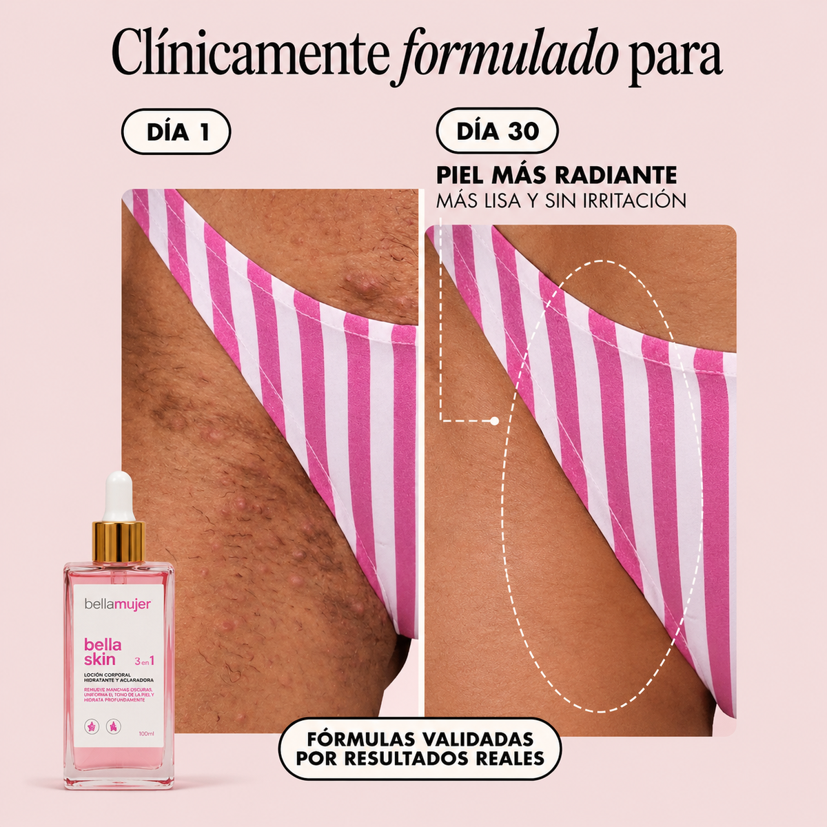 Bella Skin™ - Aceite Regenerador Post-Depilación