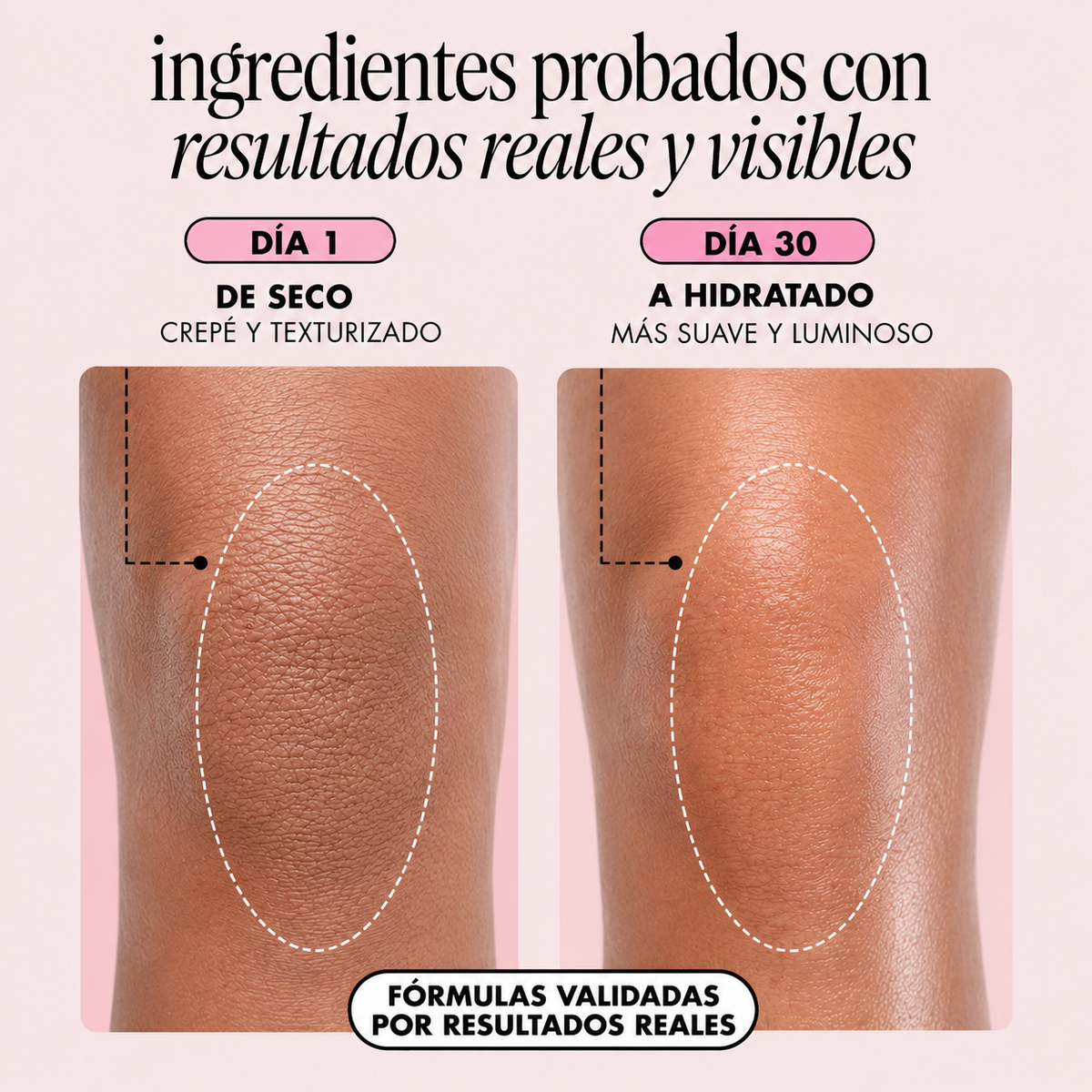 Bella Skin™ - Aceite Regenerador Post-Depilación