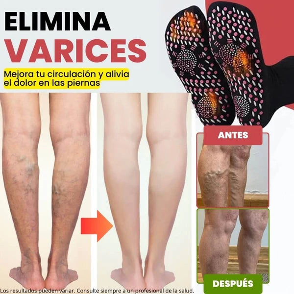 Calcetines de acupresión Anti-Varices